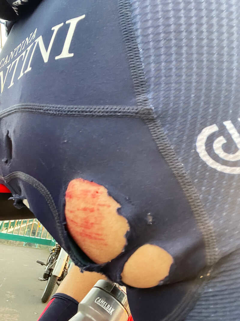 Torn and bleeding backside of spandex wearing cyclist